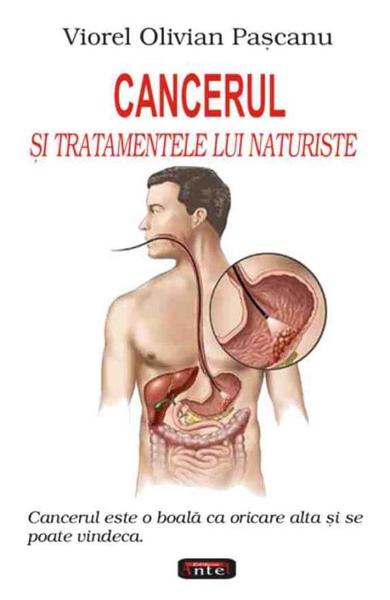 CENCERUL SI TRATAMENTELE LUI NATURISTE VIOREL OLIVIAN PASCANU
